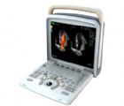 CHISON Q8 全數(shù)字彩色超聲診斷系統(tǒng)
